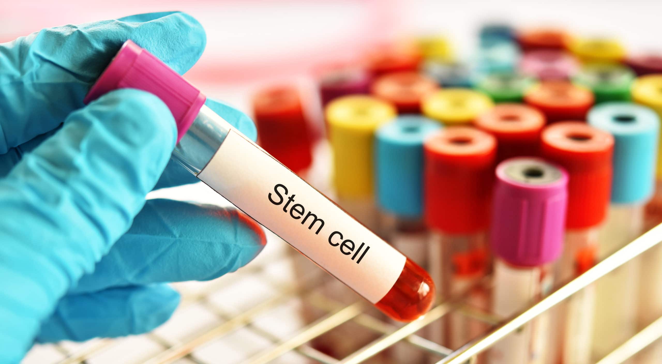 stem cells in blood sample tube