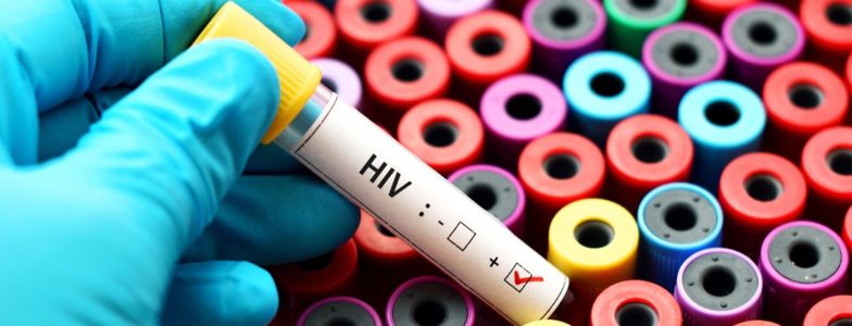 HIV positive