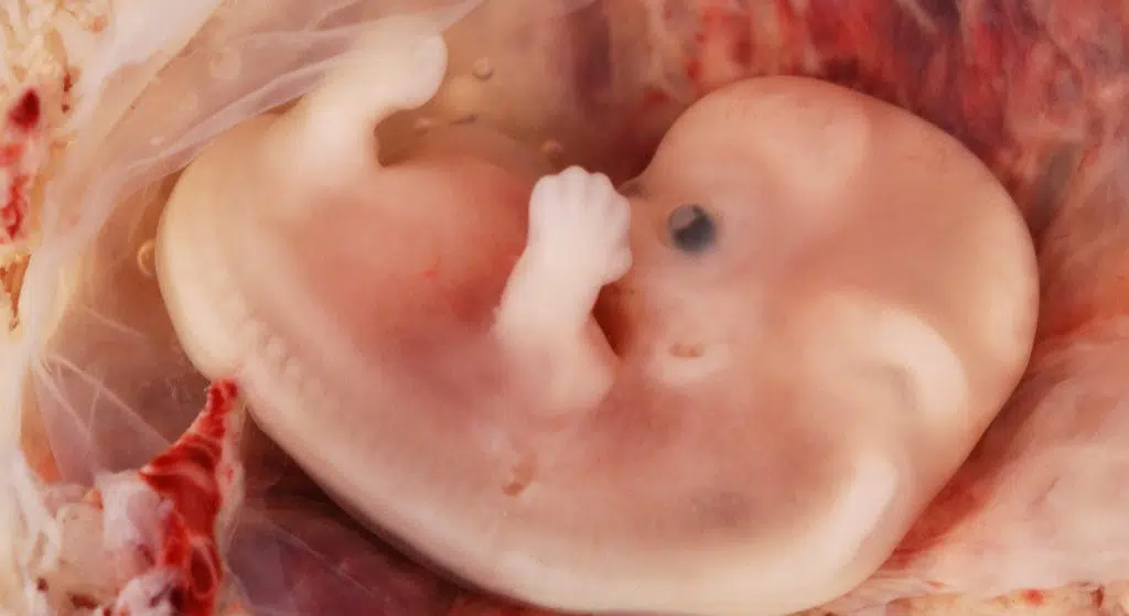 human embryo