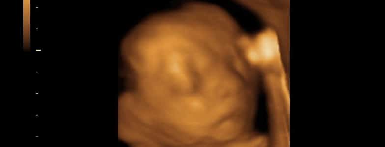 3D ultrasound of a baby at about 21 weeks