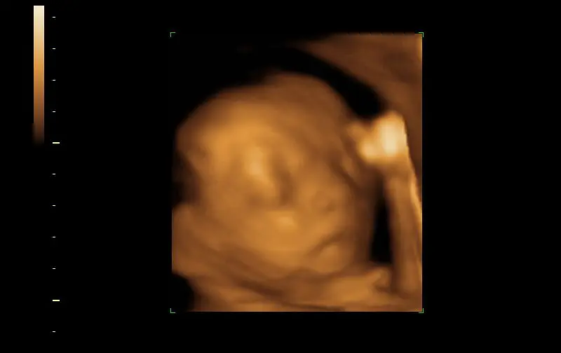 3D ultrasound of a baby at about 21 weeks