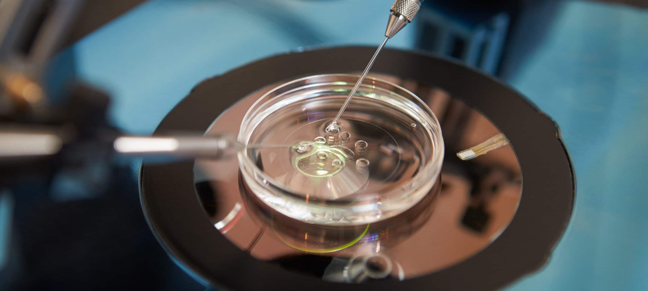 Human Conception: When Does Life Begin?