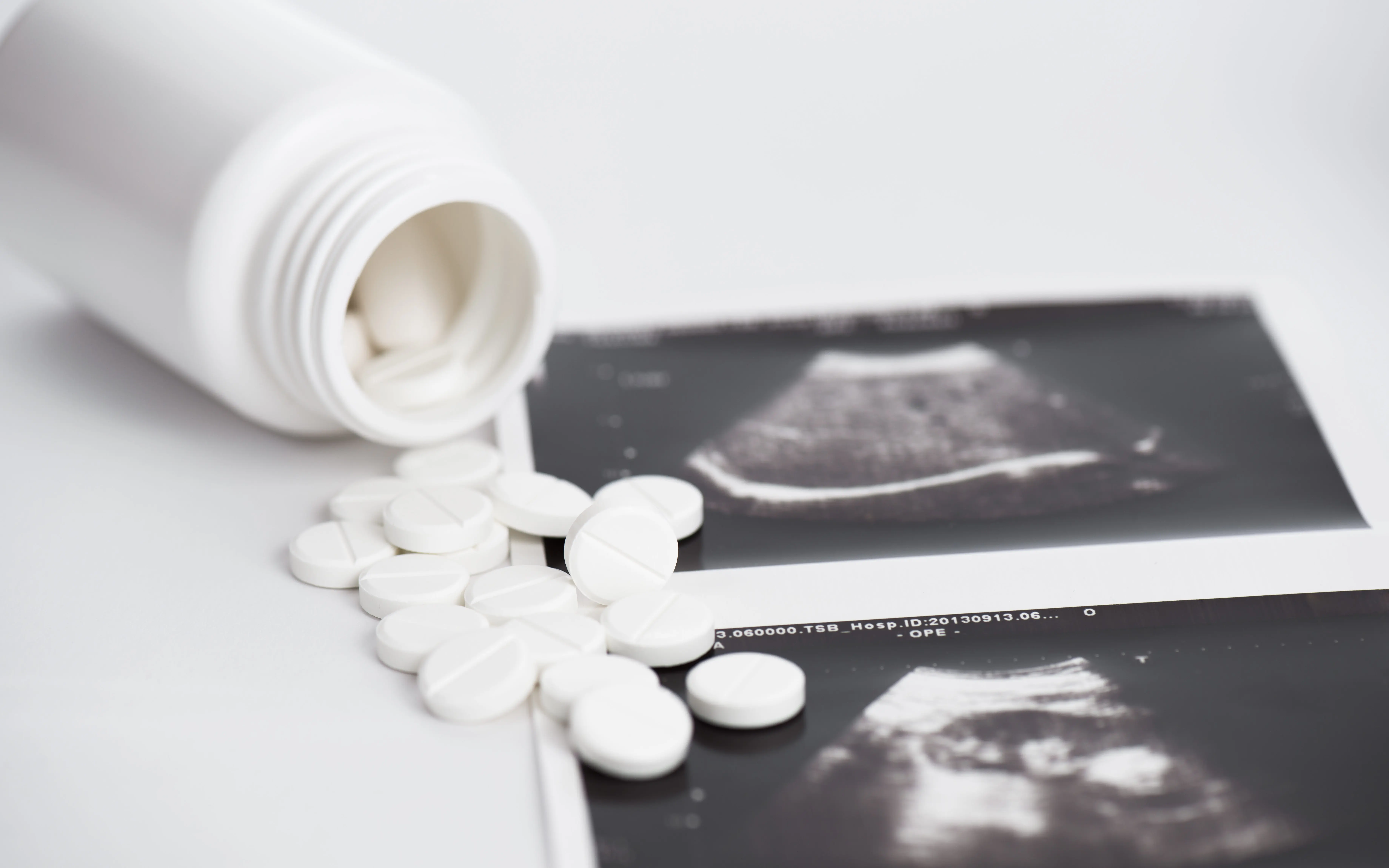 ru-486 abortion pill with ultrasound