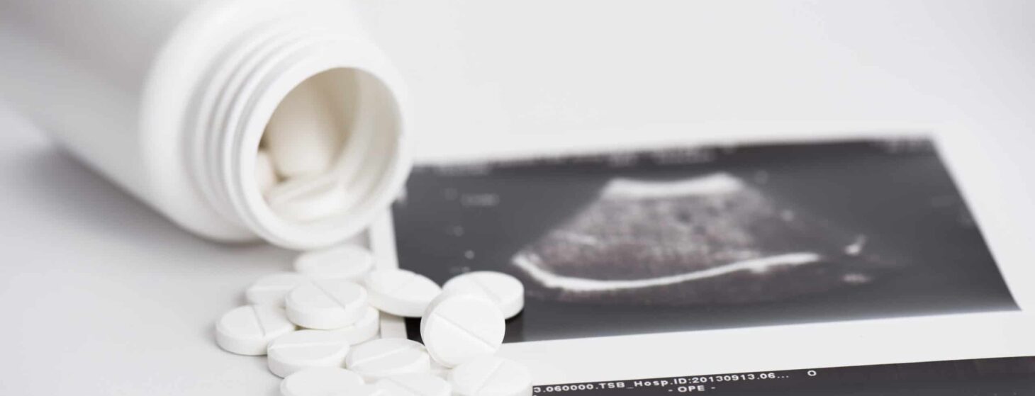 abortion pills with ultrasound