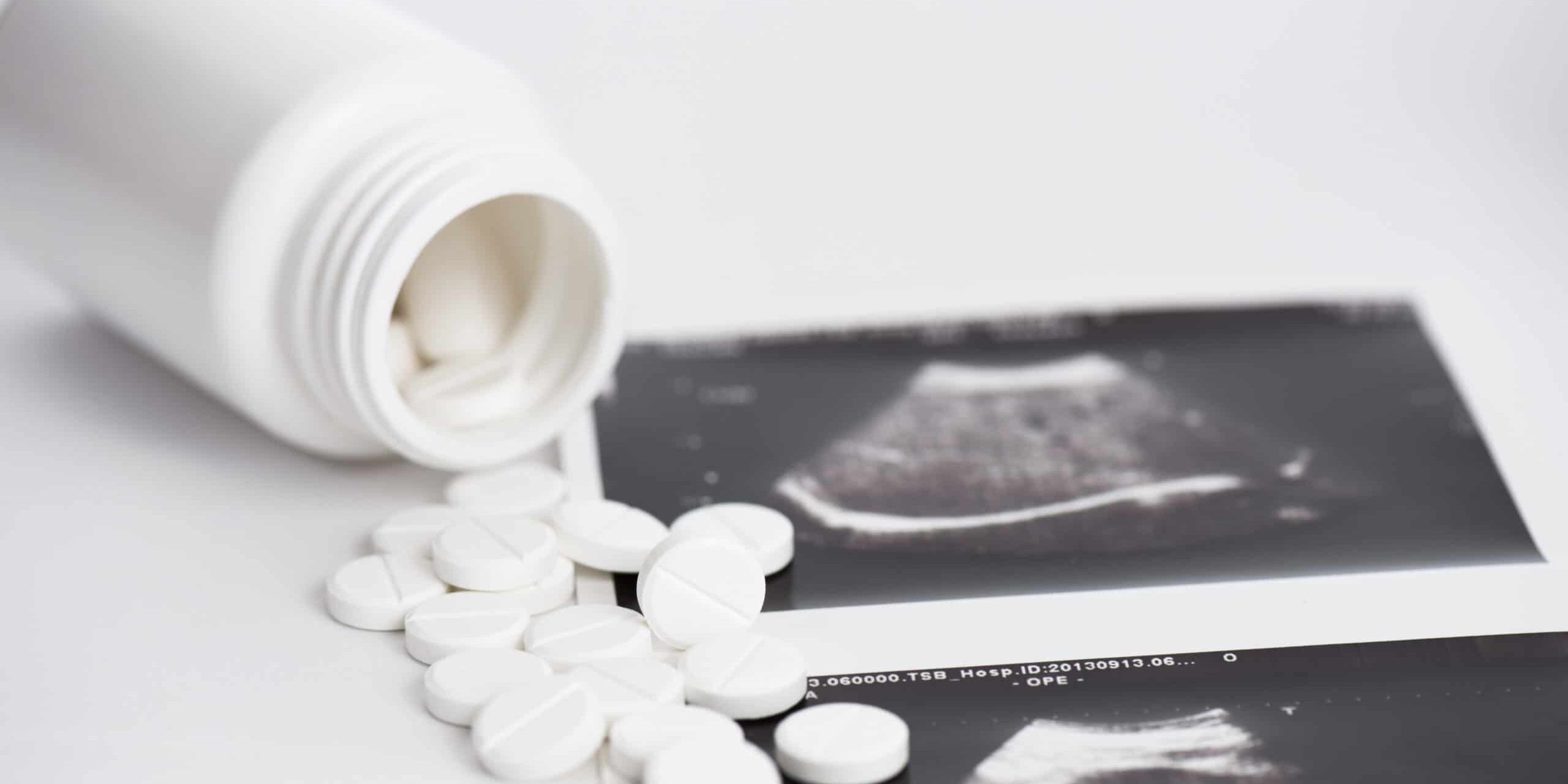 abortion pills with ultrasound