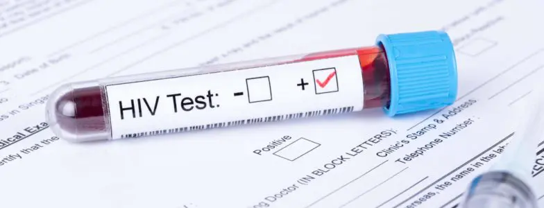 HIV positive test sample with medical forms