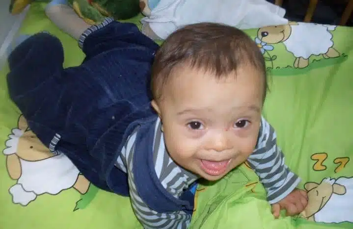a baby with down syndrome; should we allow abortion for birth defects?