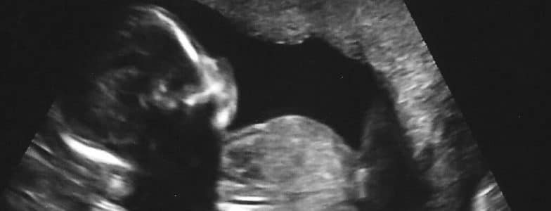 baby in ultrasound