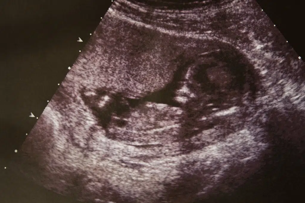 baby in the womb ultrasound