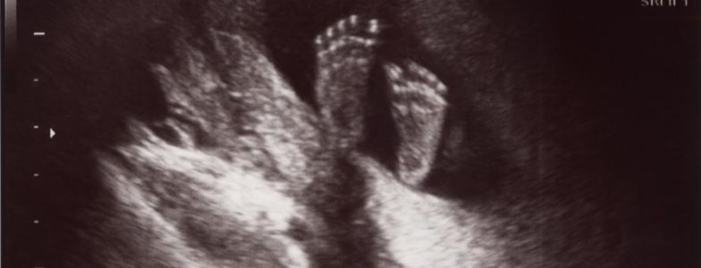 baby feet 22 weeks