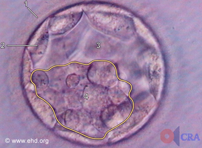 a blastocyst