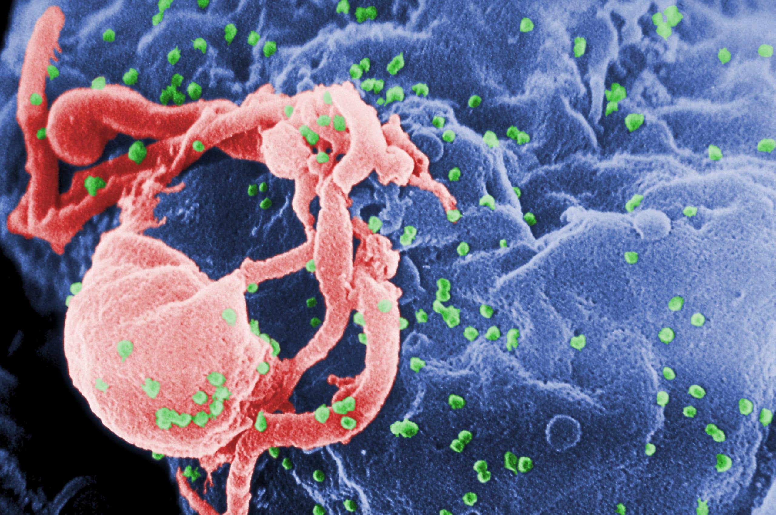 the HIV virus
