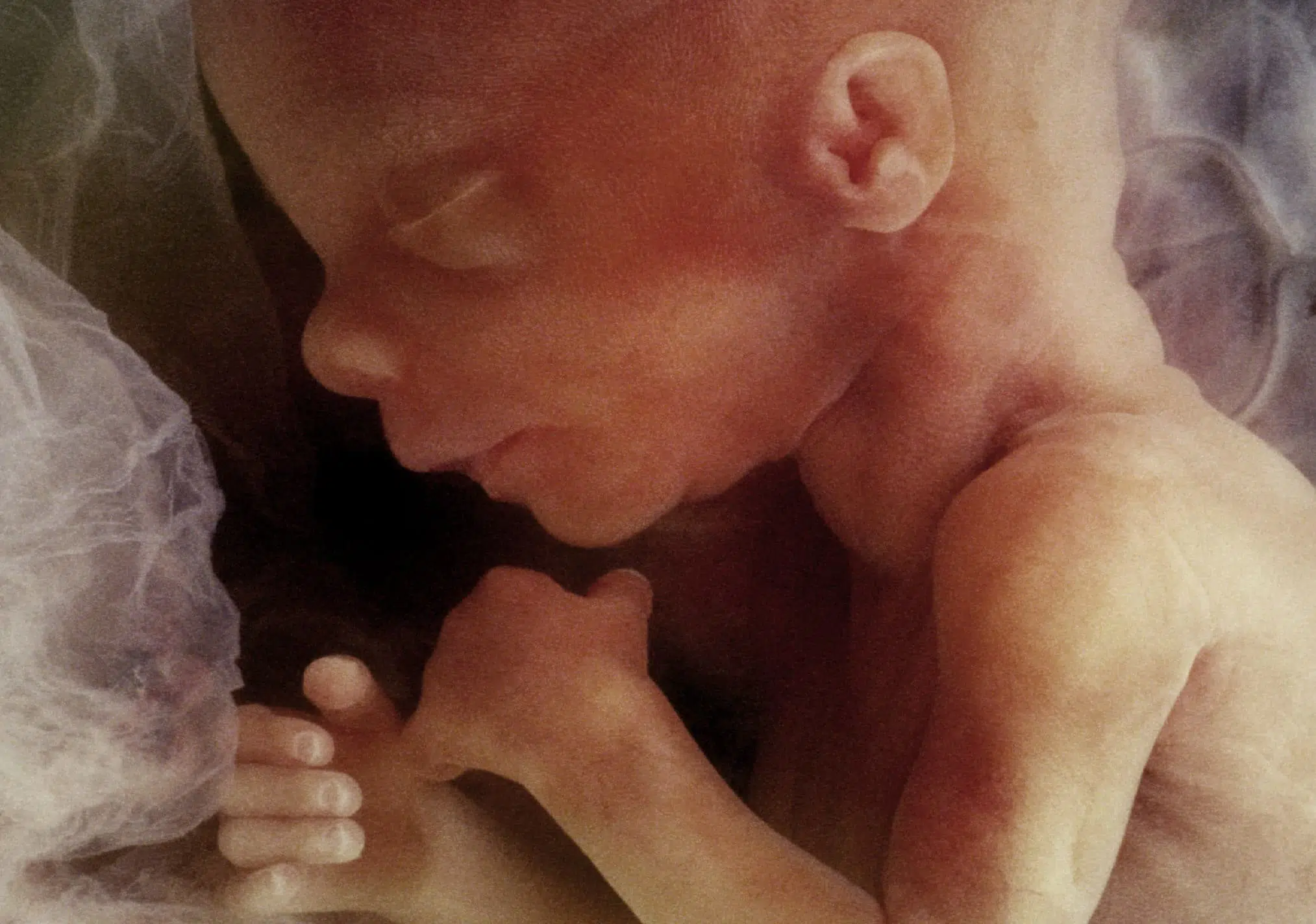 fetus at 12 weeks, unborn child