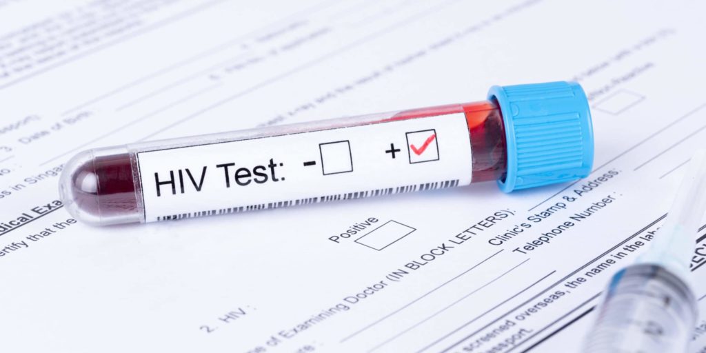 HIV positive test sample with medical forms. Is AIDS a gay disease?