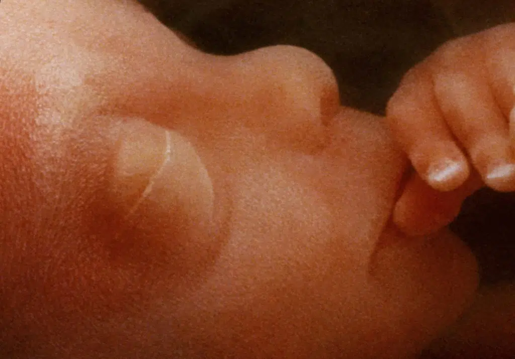 In vitro image of a human fetus in the womb - approx 12 weeks.