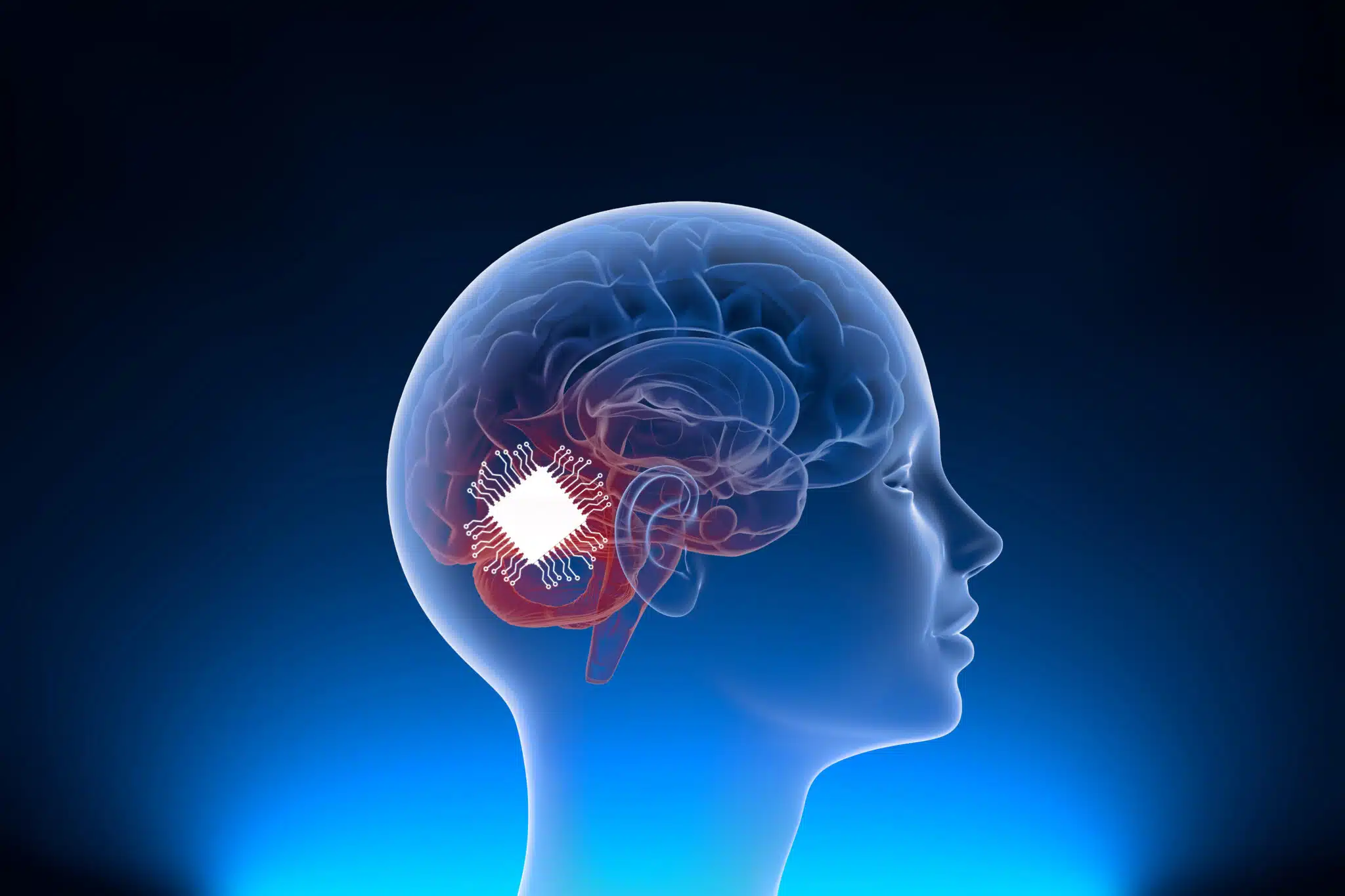 neuralink brain implant