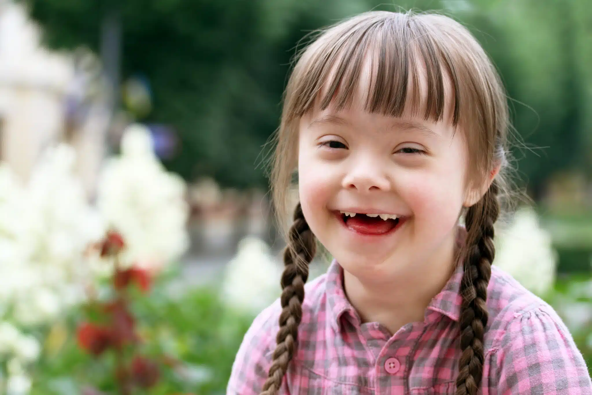 portrait of beautiful girl with down syndrome smiling