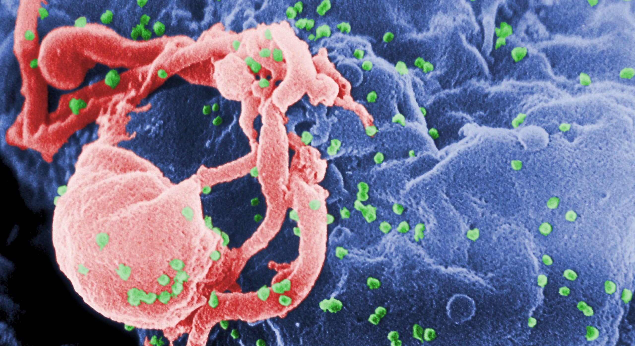 Scanning electron micrograph of HIV-1; homosexuality is not a healthy lifestyle