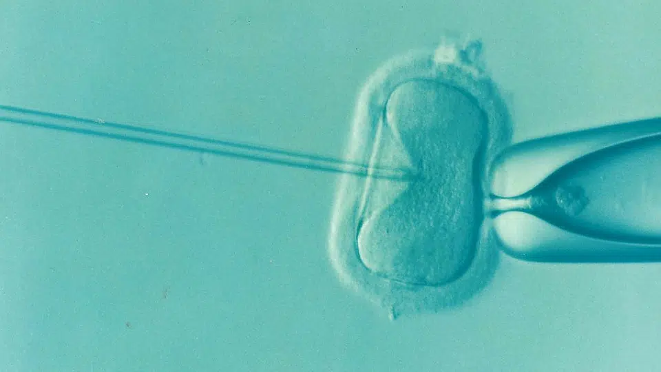 ivf in vitro fertilization