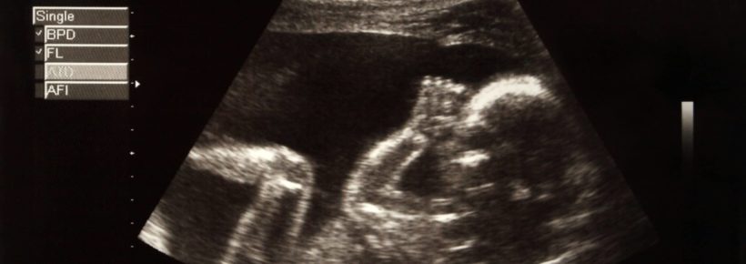 picture of a baby in the belly of her mother Picture of a baby in the belly of her mother