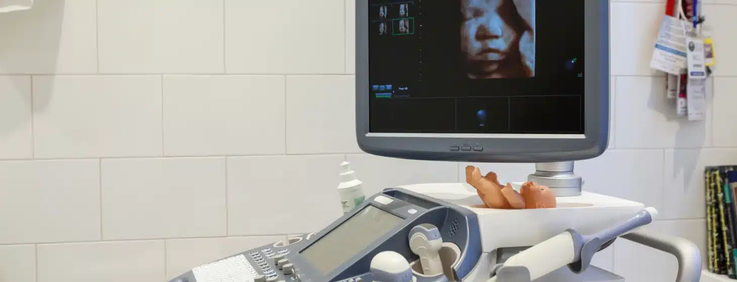 3d ultrasound on screen in a hospital