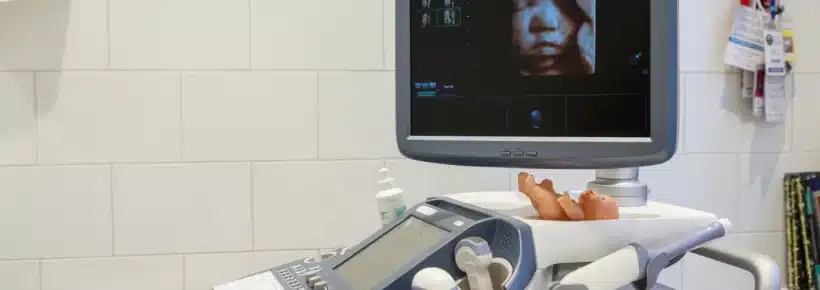 3d ultrasound on screen in a hospital