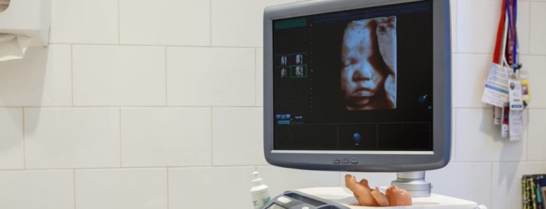 Ultrasound 3d photo of unborn baby in mother's womb, an ultrasonographer apparatus