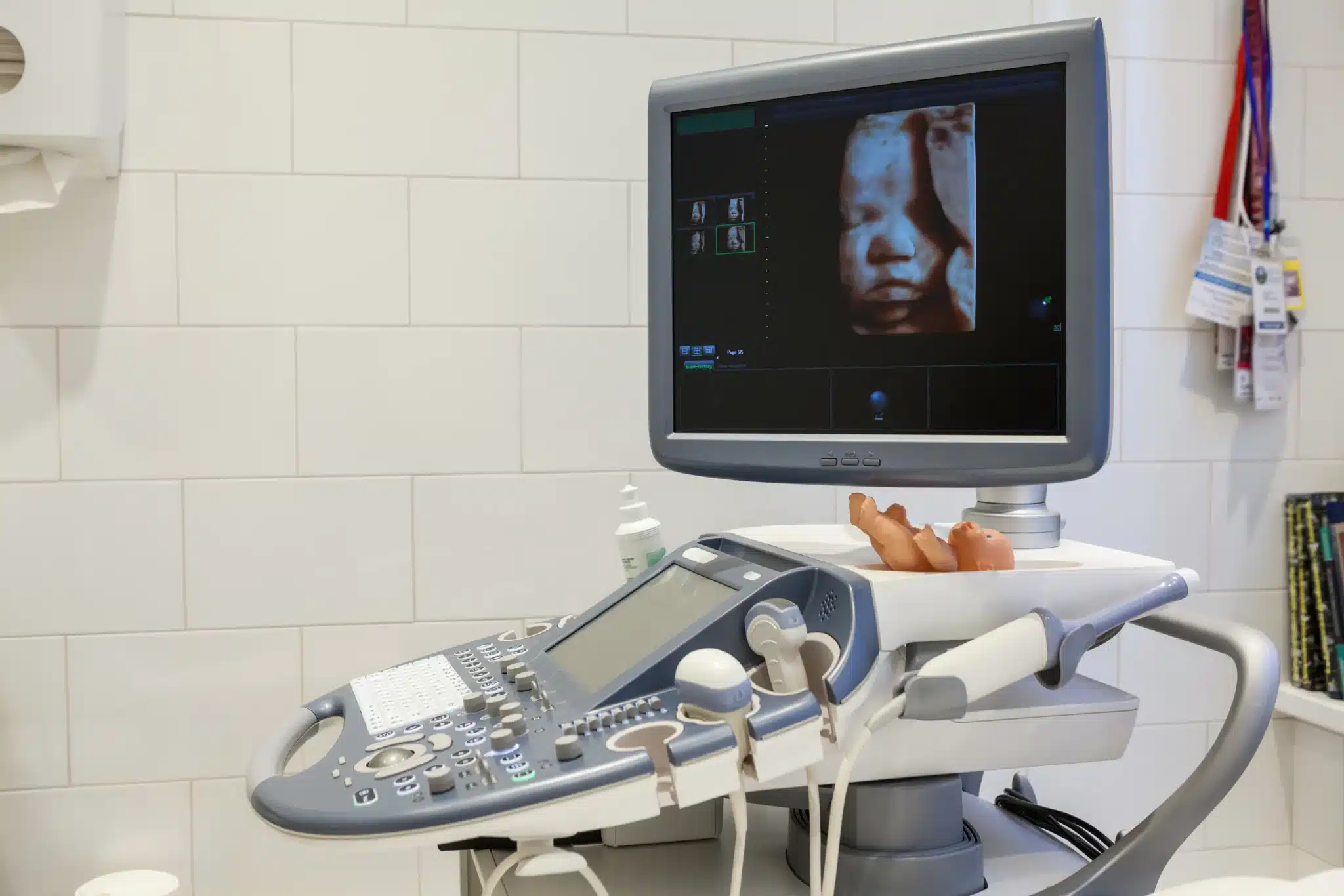 3d ultrasound on screen in a hospital