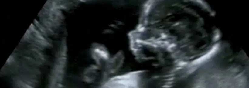 Unborn Children Found in DC Show Abortion Violence