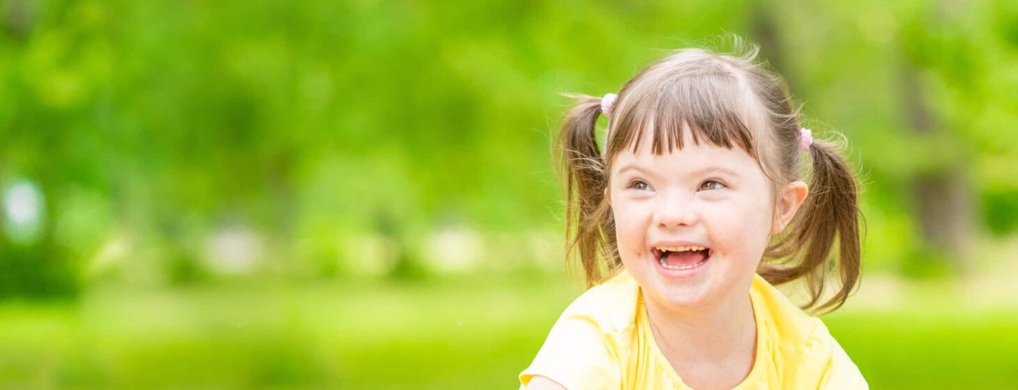 Portrait of a joyful little girl with syndrome down in a summer park