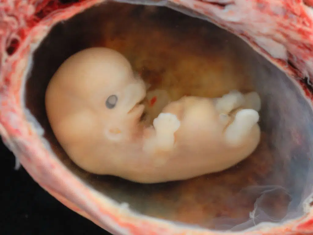 human embryo 8 weeks gestational age