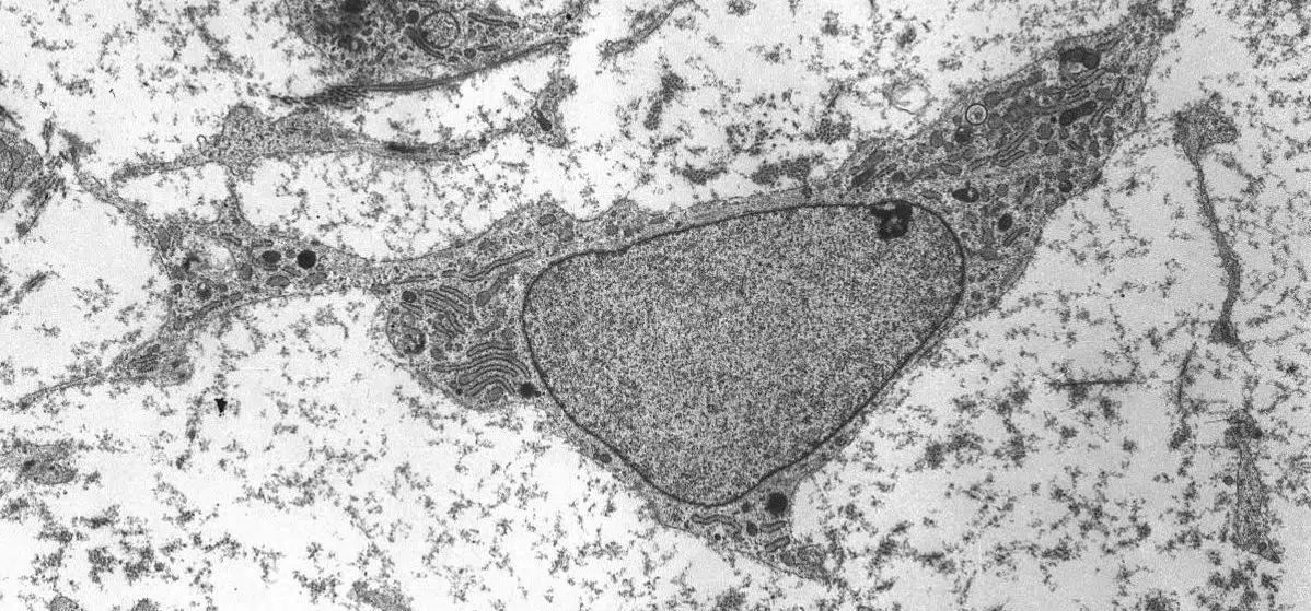 adult stem cell MSC high magnification