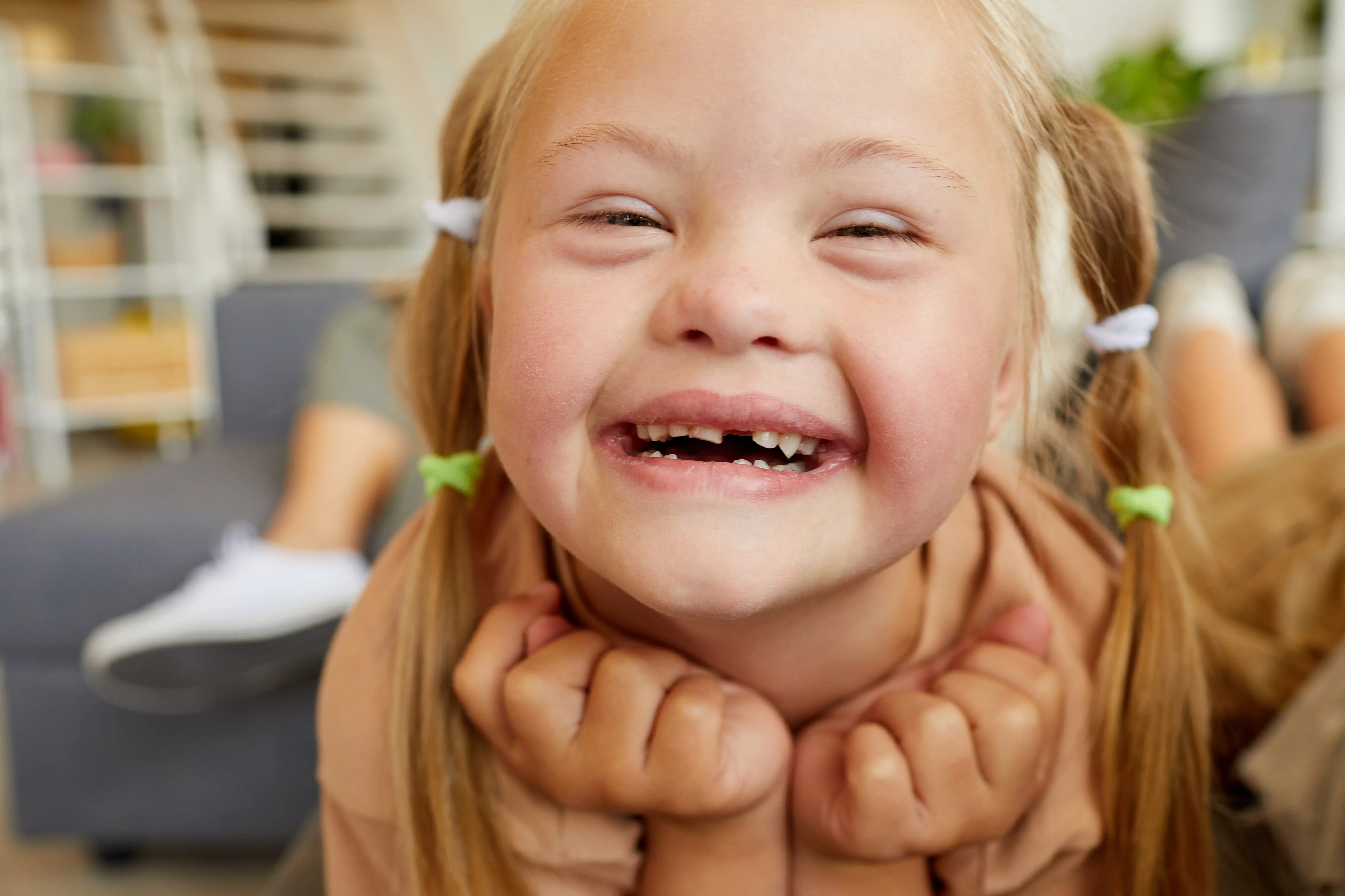 close up of blond girl with down syndrome smiling