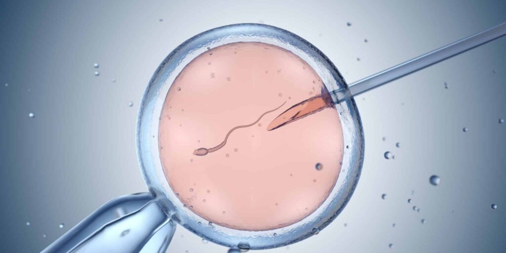 Artificial insemination or IVF