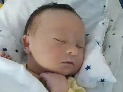 down syndrome baby